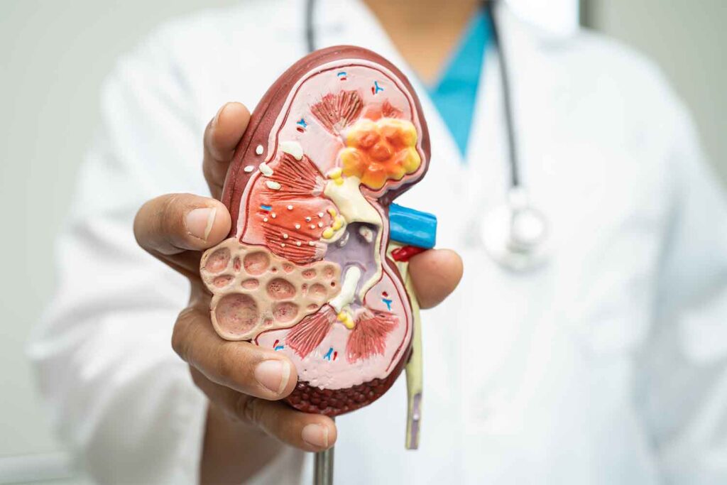Nephrology